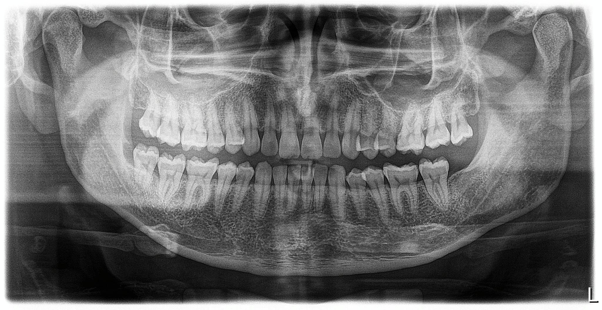 Radiografia panorâmica odontológica exibida no prontuário
